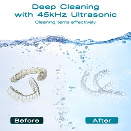 MNTNCO Ultrasonic Retainer Cleaner, White‌ Ultrasonic Retainer Cleaning Machine, Cleaner for Denture,Nightguard,Mouth Guard, Touch Retainer Cleaner.