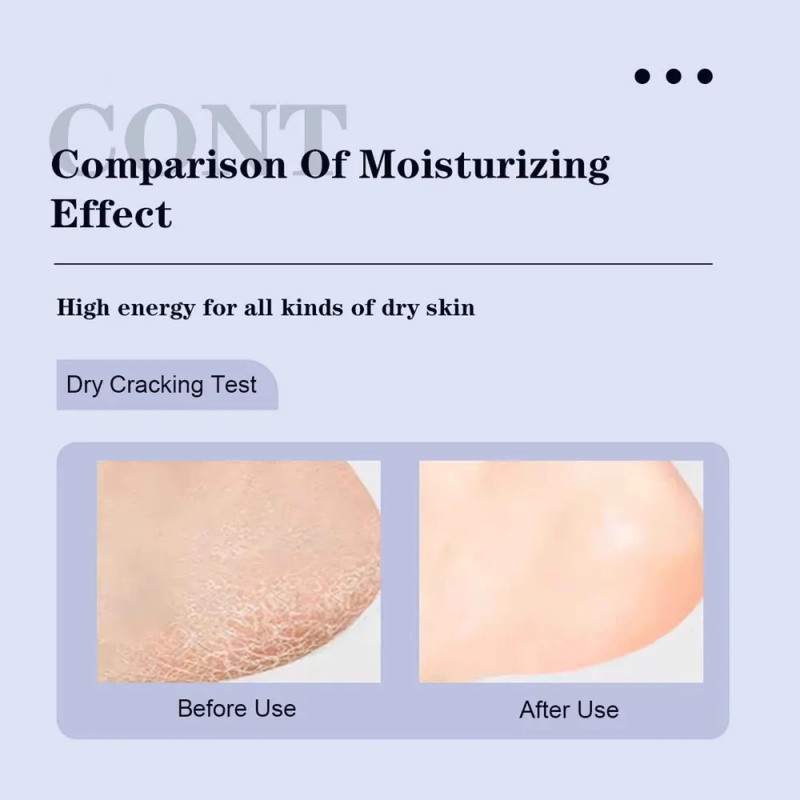 V Urea Cream Crema De Pies Con Urea Intensiva Con