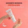BENTON Goodbye Red Centella Gel
