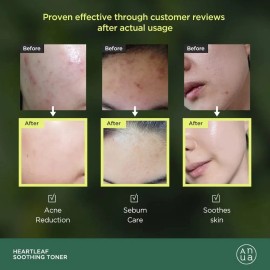 ANUA Heartleaf 77 Tnico Calmante PHA para exfoliar y eliminar piel muerta - De uso diario y pH 5.5 250ml                                              