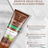 AICHUN BEAUTY Peeling Gel Face Body Removes Skin Aging Keratine