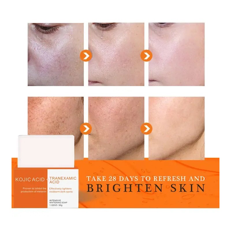 Jabón Facial Kójic Tranexámico 30g Mancha Melasma (2 Piezas)