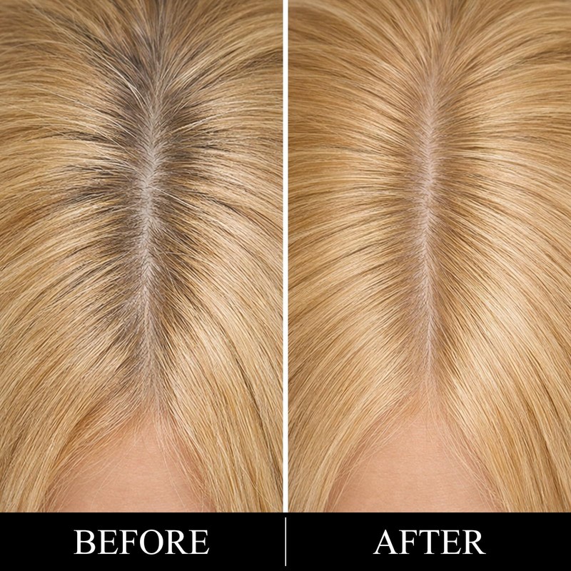 Root Touch Up Hair Color – 3 Color Blendable Hairline