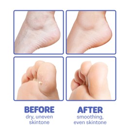 Innerest ONSOI 24PK Shea Butter & Coconut Foot Mask for Dry Cracked Feet, Feet Masks after Foot Feeling Mask, Baby Feet, Pedicure Essential (24PK Coconut & Shea Butter)