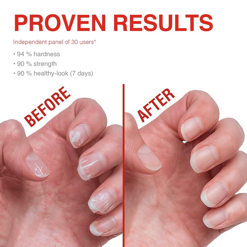 Probelle Nail Strengthener, Nail Strengthening Treatment, Nail Growth and Repair,