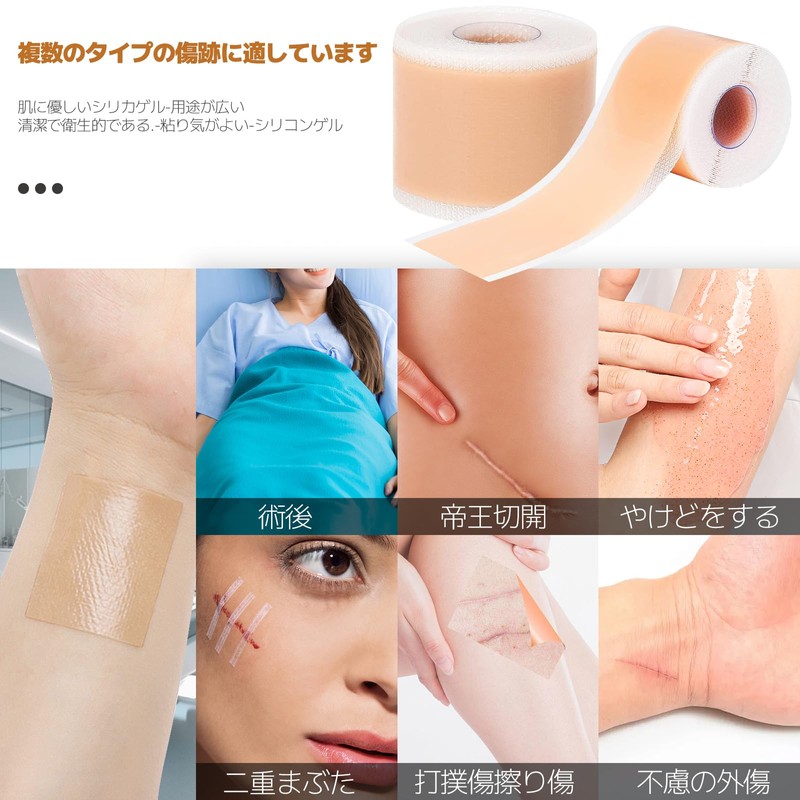 TiaysTiays 傷跡ケアテープ ケロイド テープ 4cm×300cm 肌色 傷あとケア用シリコンジェルシート 傷隠しテープ