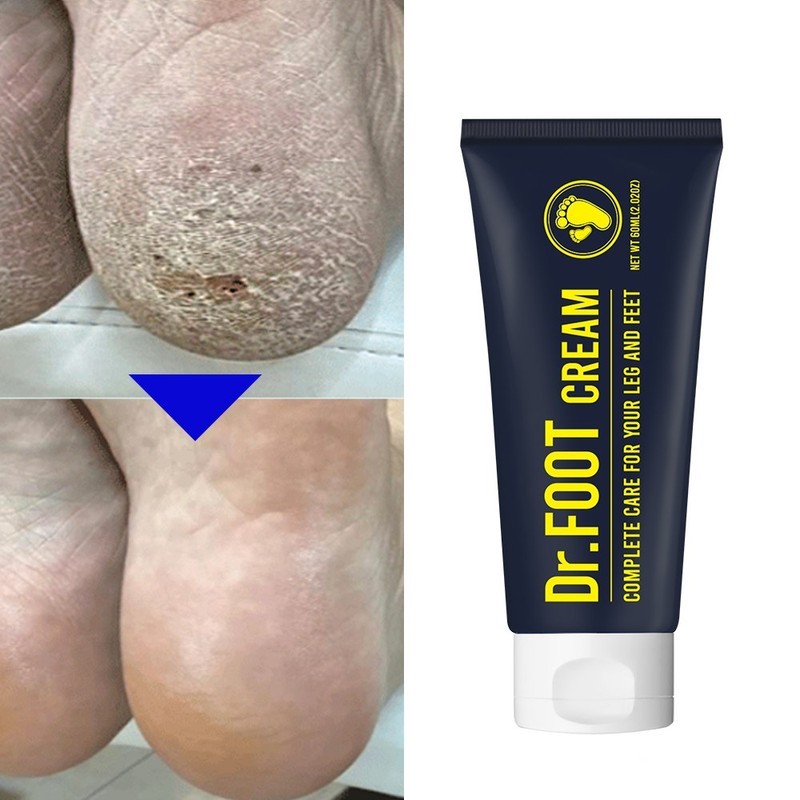 Dr. Foot Anti-Odor Heel and Ankle Foot Cream for Callus,