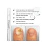 Lápiz Antimicótico Lunavia 3 Pzas 3 Ml Uñas Beige