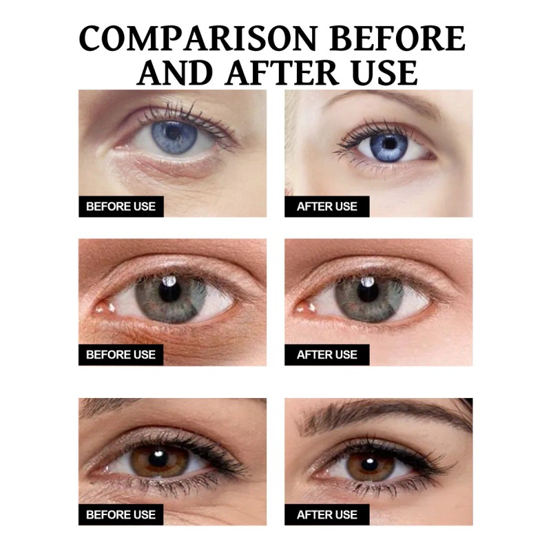 La Crema Reafirmante De Ojos Reduce Las Arrugas