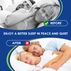 Pack of 8 Snoring Stoppers, Anti Snoring, Improve Breathing, Improve