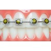 Snapcaps Braces Bumper Cover, Orthodontic Bracket Wax Substitute, Alternative Snap-on