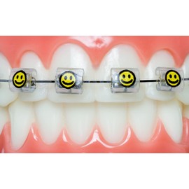 Snapcaps Braces Bumper Cover, Orthodontic Bracket Wax Substitute, Alternative Snap-on Braces Guard Braces Accessories 10 pack (Smiley Face)
