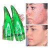 Gel Aloe Antiacné 120 ml Hidratante Anti-Irritaciones Piel Mixta Día