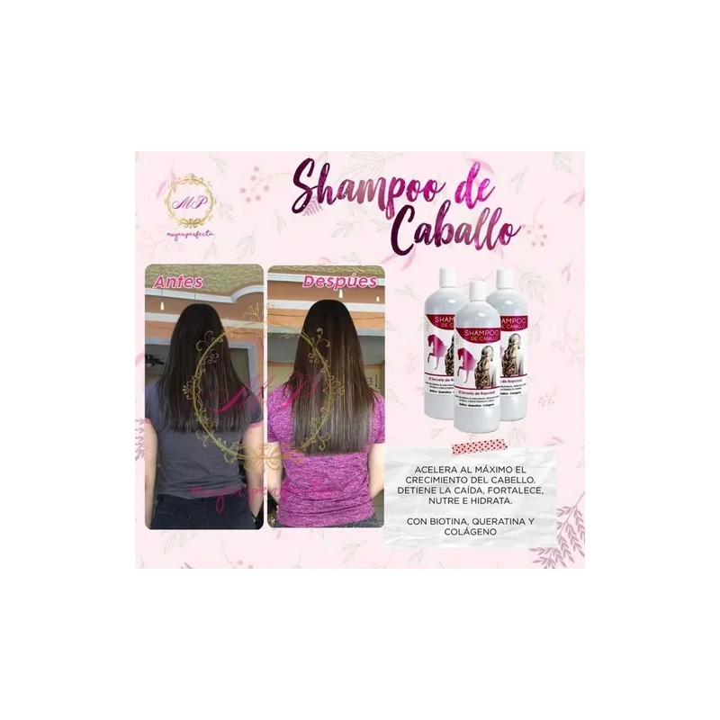 Shampoo De Caballo Detiene La Caída Acelera El Crecimiento