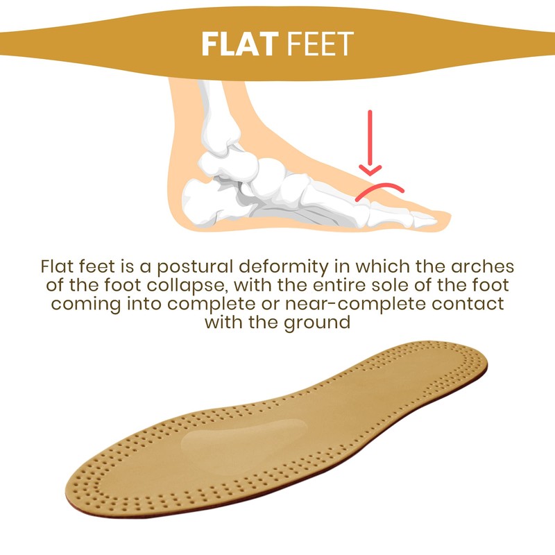 Vaya Exclusivo Primo Orthopaedic Insoles for Flatfoot Hallux Valgus with