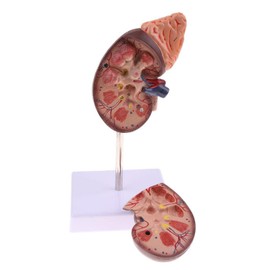 Kidney Anatomy Model, Life Size Kidney Anatomically Teaching Divided into 2 Parts Showing Internal Structure A Normal Kidney Human Anatomy Replica for Teachers or Doctors Office, Includes Base