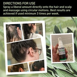 Amplixin Intensive Biotin Hair Growth Serum - Hair Loss Prevention Treatment For Men & Women With Thinning Hair - Sulfate-Free DHT Blocker For Recedin