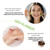 2pcs Gel Aloe Vera Anti-manchas Anti-acne Vitamina E Hidrata Normal