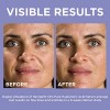 L'oreal Paris Skincare Revitalift Derm - Suero De Ácido Hial