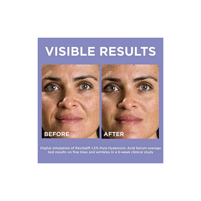 L'oreal Paris Skincare Revitalift Derm - Suero De Ácido Hial