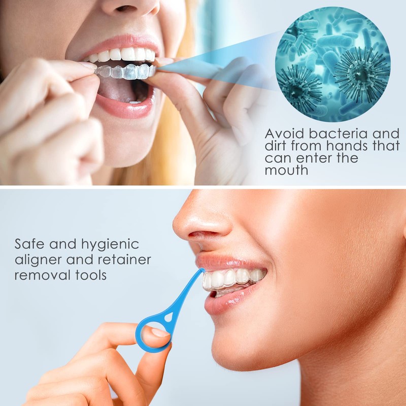 ARGOMAX - Aligner Removal Tool, 5 Invisible Braces Removal Tools,