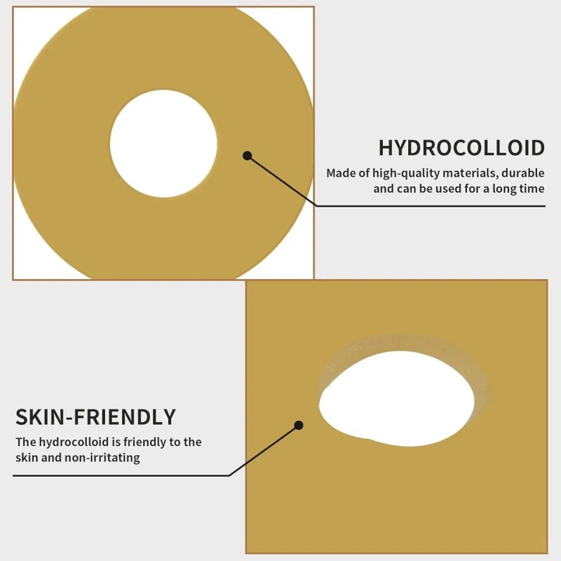 20pzas 4mm Anillo Barrera Para Ostomía 50mm