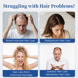 Gluvelessia Hair Growth Serum Roll On 25ml with Saw Palmetto, Rosemary & Pea Extract， Helps Support Thicker, Fuller Hair Appearance， Clean, Non-Greasy Hair Loss Support for Men & Women Pack of 1