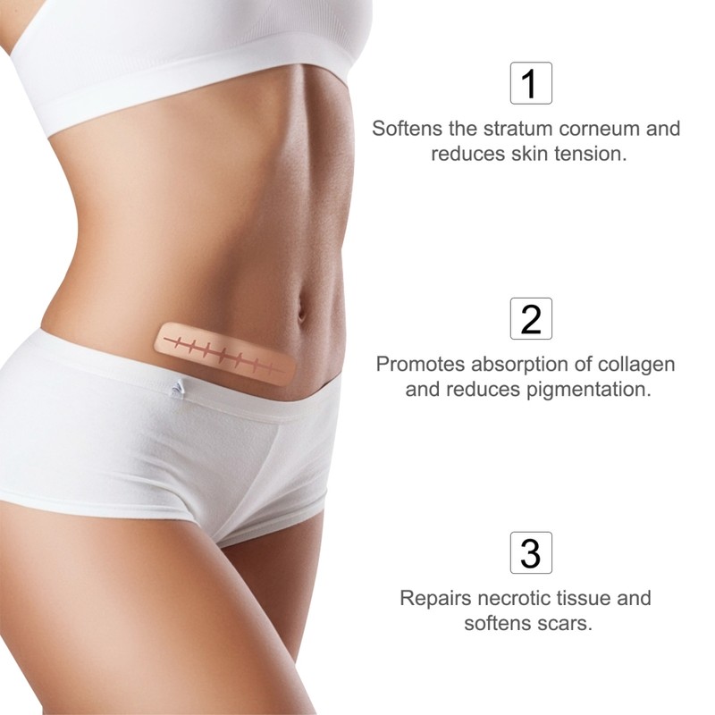 3 Meters Silicone Scar Stickers to Reduce Itching and Redness