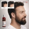 BOTIKA GRISI Shampoo Anticaída Natural con Jalea Real, 480 ml