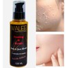 Walee Professional Peeling & Scrub, Face & Body Scrub, 5-Minute