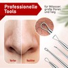 NEUMANN® Blackhead Remover Set (Stainless Steel) for Removing Pimples, Blackheads