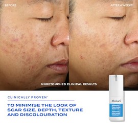 Blemish - Invisiscar treatment  Tratamiento localizado para marcas de acn, con cido saliclico 15 ml.                                                  