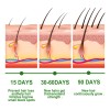 3pcs Hair Growth Aceite Esencial Romero 100% Puro Natural