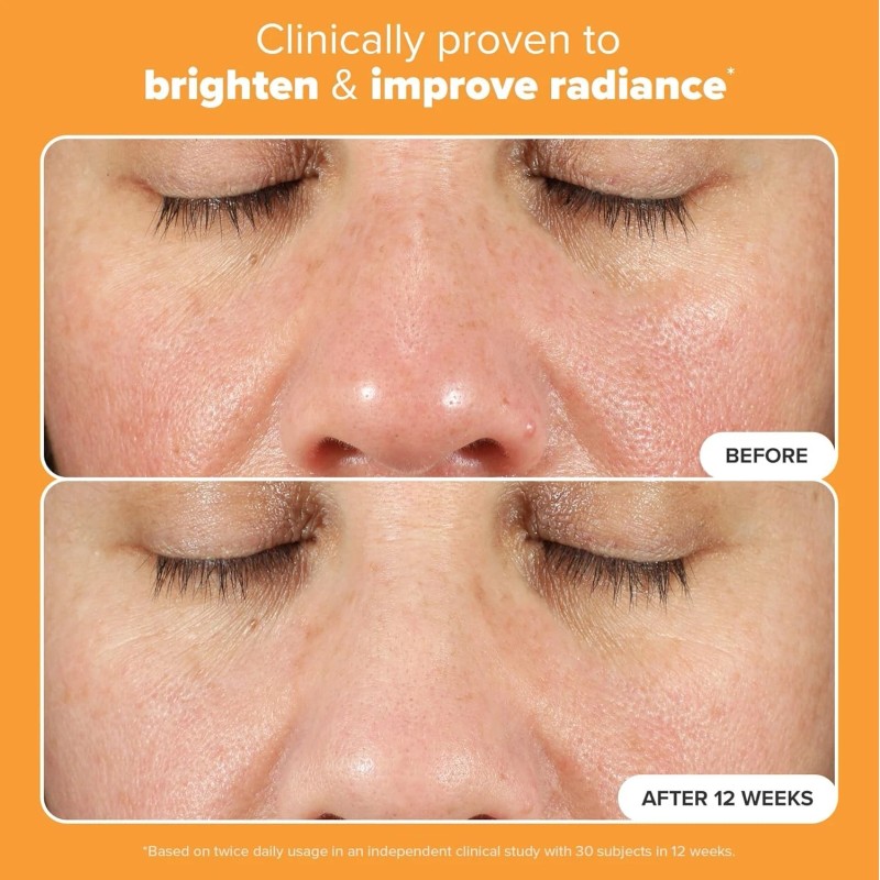 Paula's Choice Boost C15 Super Booster 15% Vitamin C 20ml