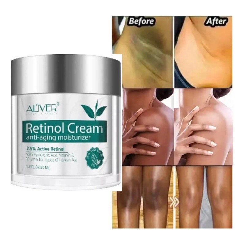 Crema Retinol Aclarante Zonas Intimas Perianal Entrepierna Neutra