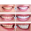 Yejoby 2PCS-SP-6 Whitening Toothpaste, Teeth Whitening, Enamel-Safe, Fluoride-Free, Fresh Mint,