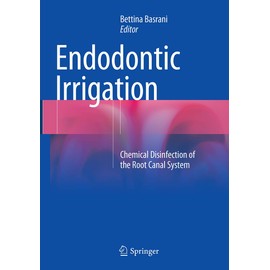 Endodontic Irrigation: Chemical disinfection of the root canal system