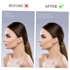 GAROZATION 5Pcs Women Hair Padding Clips Volumizing Hair Styling Tool for Updos and Buns Delicate Hair Clamps Accessories for Increased Volume and Hair Cushioning