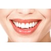 Dental Aligner Seaters for Mouth Trays - Green/Mint Scented -