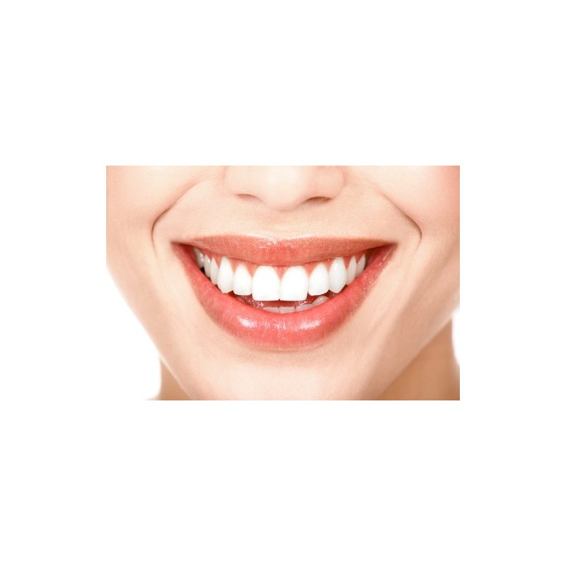 Dental Aligner Seaters for Mouth Trays - Green/Mint Scented -