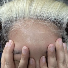 BEEOS 5x5 SKINLIKE Real HD Lace Closure Only, 613 Blonde 0.10mm Ultra-thin Invisible Swiss Lace Ultimate Brazilian Hair Pre-Plucked Natural Hairline Silky Straight 20 Inch