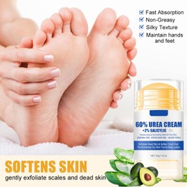 2PCS Urea Cream 60 Percent for Feet & Hands – Honey & Urea Foot Cream, Intensive Foot Moisturiser, Cracked Heel Repair Cream for Dry Skin & Hard Calluses, Exfoliating Foot Balm, Hydrating Dry Skin