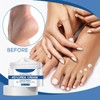 Grospe Urea Cream 45 Percent for Feet Maximum Strength, Moisturizes