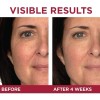 L'oreal Paris Skincare Revitalift Triple Power Crema De Ojos