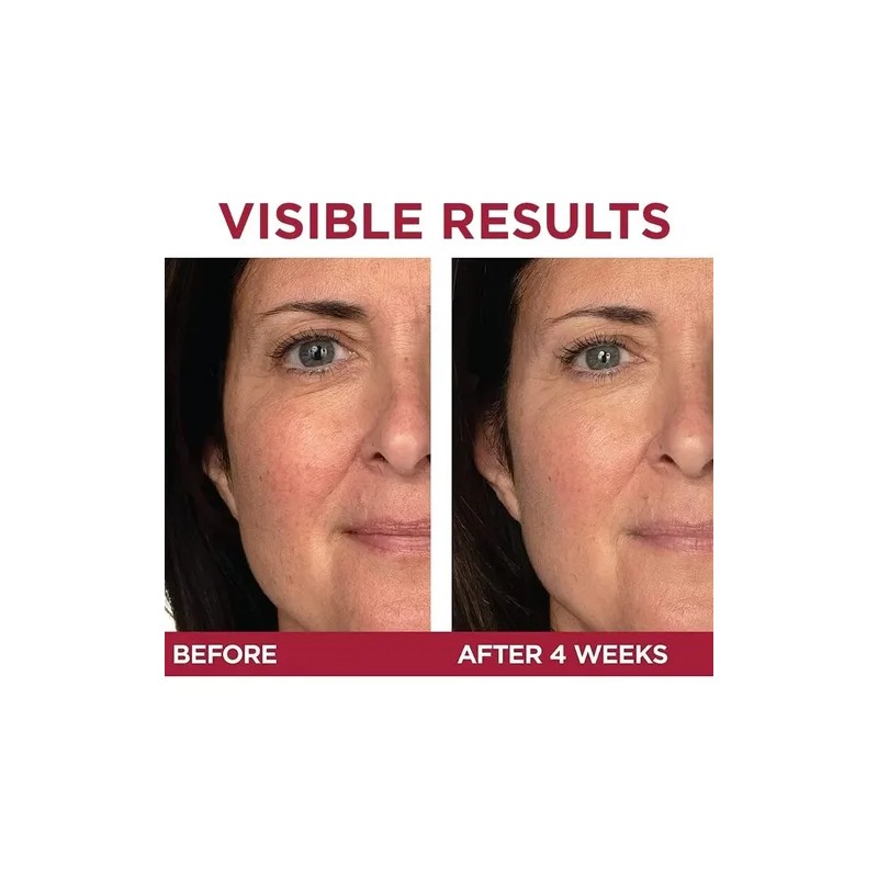 L'oreal Paris Skincare Revitalift Triple Power Crema De Ojos