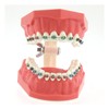 Dentalmall Typodonts Orthodontics Demonstration Model with Metal Wires and Bracket