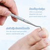 Pack of 150 Nail Clips Toenails, Ingrown Toenail Correction, Nail