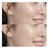 V Yyds - 2026 Pack 2 Crema Centella Asiática Ilumina
