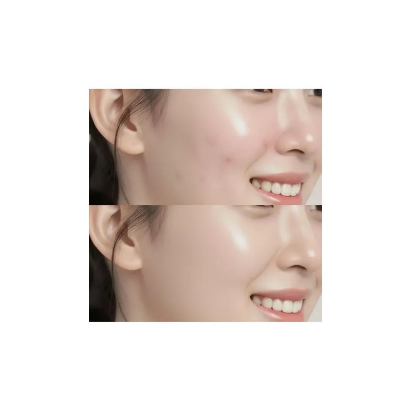 V Yyds - 2026 Pack 2 Crema Centella Asiática Ilumina