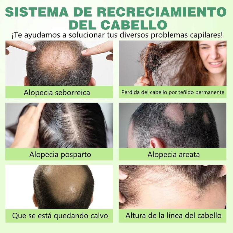 Hair Treatment Seru, Deja el Cabello Más Suave y Grueso